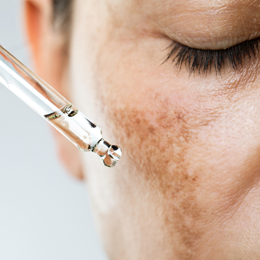Dermatology