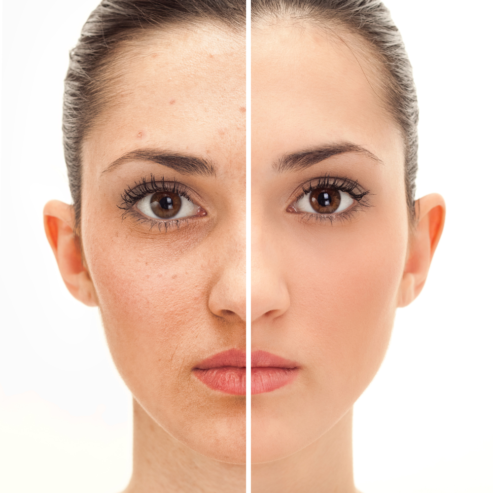 Anti-aging/pigmentation